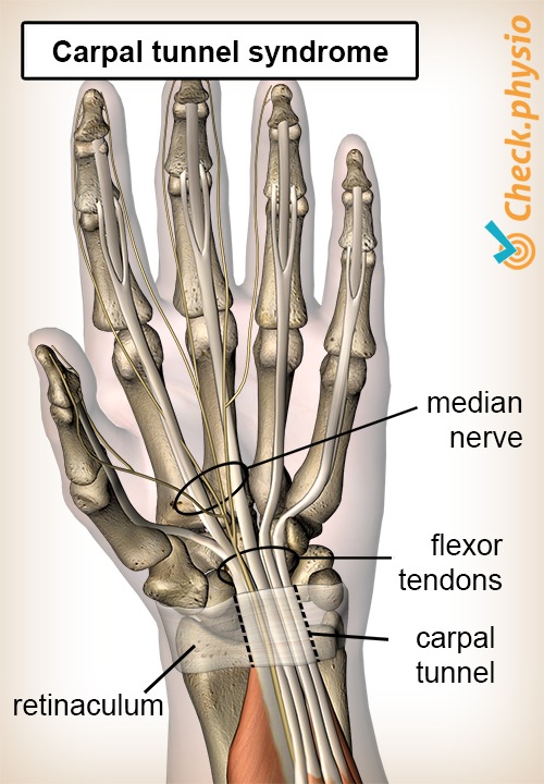 What is the Carpal Tunnel?, Wrist Tendons