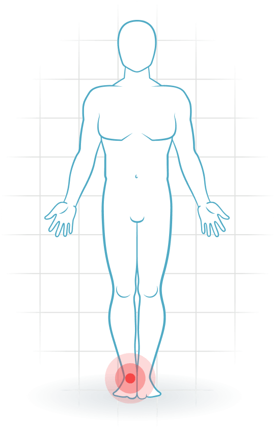 pijnlocatie Anterior ankle impingement