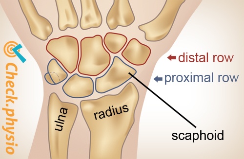 DISI deformity | Physio Check